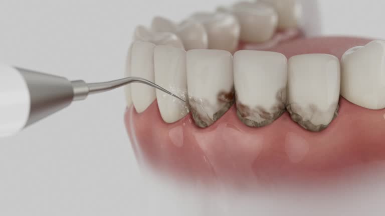Trusted Dental Implants service in Gloucester Courthouse, VA - Dentist Open Now